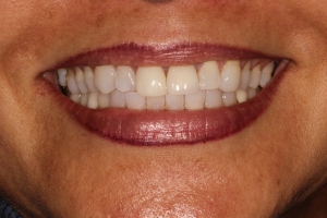 Smile